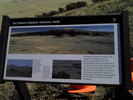 Raton-Clayton sign
